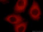STARS/ABRA Antibody in Immunocytochemistry (ICC/IF)