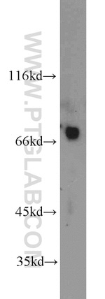 TBX18 Antibody in Western Blot (WB)