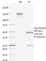 AMACR/p504S Antibody in SDS-PAGE (SDS-PAGE)
