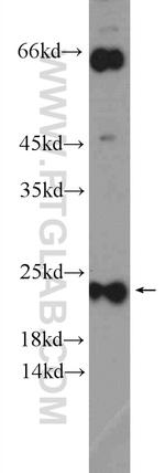 MUTED/BLOC1S5 Antibody in Western Blot (WB)