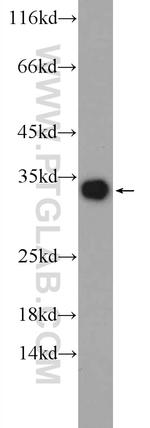 MBL2 Antibody in Western Blot (WB)