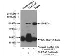 Sodium Iodide Symporter Antibody in Immunoprecipitation (IP)