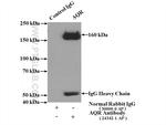 AQR Antibody in Immunoprecipitation (IP)