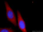 AMZ1 Antibody in Immunocytochemistry (ICC/IF)