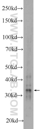 AMZ1 Antibody in Western Blot (WB)
