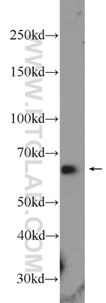 PPP2R3B Antibody in Western Blot (WB)
