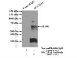 SLC22A1 Antibody in Immunoprecipitation (IP)