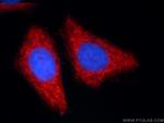 ANKS1B Antibody in Immunocytochemistry (ICC/IF)