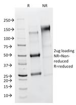 FSH-Receptor Antibody in SDS-PAGE (SDS-PAGE)