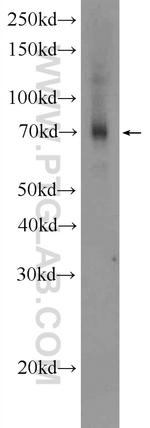 FDXACB1 Antibody in Western Blot (WB)