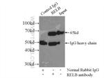 RelB Antibody in Immunoprecipitation (IP)