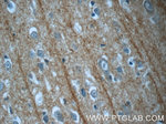 DNAH14 Antibody in Immunohistochemistry (Paraffin) (IHC (P))