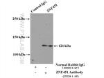 ZNF451 Antibody in Immunoprecipitation (IP)