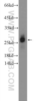 ZNF740 Antibody in Western Blot (WB)