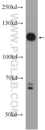 STK10 Antibody in Western Blot (WB)