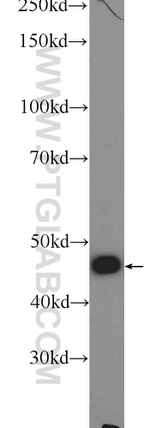 ZNF323 Antibody in Western Blot (WB)
