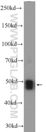 ZNF323 Antibody in Western Blot (WB)