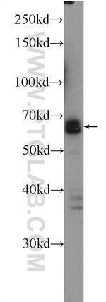SUPT7L Antibody in Western Blot (WB)