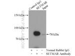 SETMAR Antibody in Immunoprecipitation (IP)