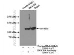 DGCR8 N-terminal Antibody in Immunoprecipitation (IP)