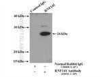RNF141 Antibody in Immunoprecipitation (IP)