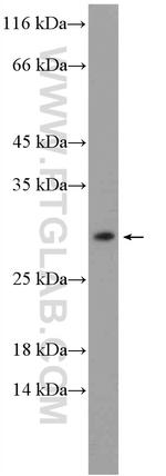 MOSPD3 Antibody in Western Blot (WB)