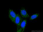 SDHD Antibody in Immunocytochemistry (ICC/IF)