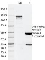 GFAP Antibody in SDS-PAGE (SDS-PAGE)