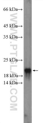 CENPA Antibody in Western Blot (WB)