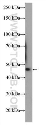 KLHDC1 Antibody in Western Blot (WB)