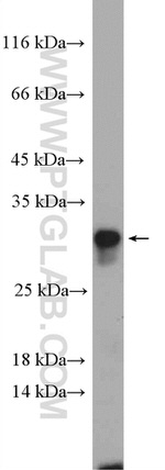 RAB33B Antibody in Western Blot (WB)