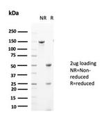 Glutamine Synthetase/GLUL Antibody in SDS-PAGE (SDS-PAGE)
