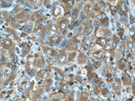 FMNL1 Antibody in Immunohistochemistry (Paraffin) (IHC (P))