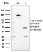 Glutathione S-Transferase Mu1 (GSTM1) Antibody in SDS-PAGE (SDS-PAGE)