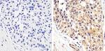 Phospho-STAT1 (Tyr701) Antibody in Immunohistochemistry (Paraffin) (IHC (P))