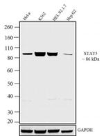 STAT5 alpha/beta Antibody in Western Blot (WB)