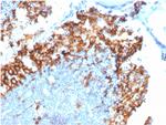 IL3RA/CD123 Antibody in Immunohistochemistry (Paraffin) (IHC (P))