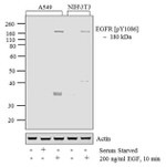 Phospho-EGFR (Tyr1086) Antibody in Western Blot (WB)