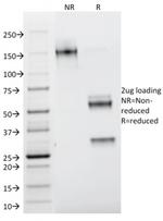Galectin-1/Human Placental Lactogen (hPL) Antibody in SDS-PAGE (SDS-PAGE)