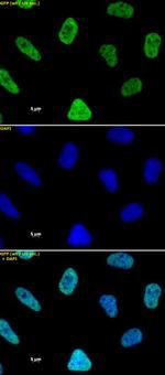 Histone H3K27ac Antibody in Immunocytochemistry (ICC/IF)