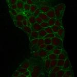 TACSTD2/TROP2 Monoclonal Antibody (TACSTD2, 2152)