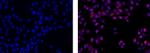 Mouse IgG2a Secondary Antibody in Immunocytochemistry (ICC/IF)