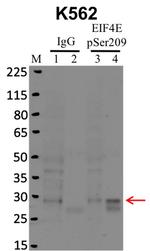 Phospho-eIF4E (Ser209) Antibody in RNA Immunoprecipitation (RIP)