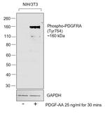 Phospho-PDGFRA (Tyr754) Antibody in Western Blot (WB)