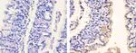Phospho-PDGFRA (Tyr754) Antibody in Immunohistochemistry (Paraffin) (IHC (P))