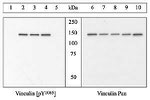 Phospho-Vinculin (Tyr1065) Antibody in Western Blot (WB)
