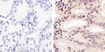 Phospho-AKT1 (Ser473) Antibody in Immunohistochemistry (Paraffin) (IHC (P))