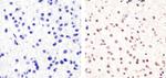 SOX2 Antibody in Immunohistochemistry (Paraffin) (IHC (P))