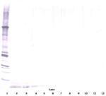 DEFA1 Antibody in Western Blot (WB)
