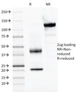 PAX2 (Renal Cell and Ovarian Carcinoma Marker) Antibody in SDS-PAGE (SDS-PAGE)